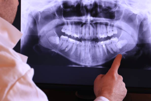 Best Emergency Denture Repair in Crescent City, CA