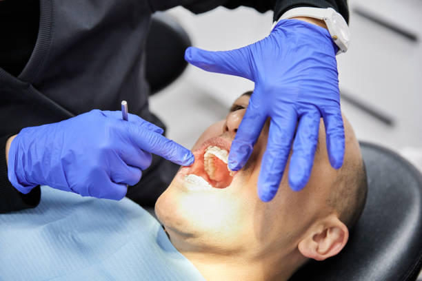 Best Dental Abscess Treatment in Crescent City, CA